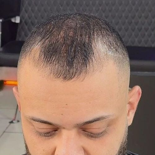 Hairline
