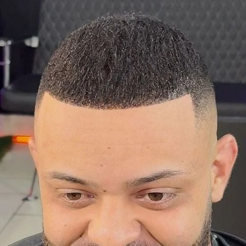 Hairline